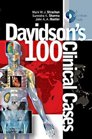 Davidsons 100 Clinical Cases